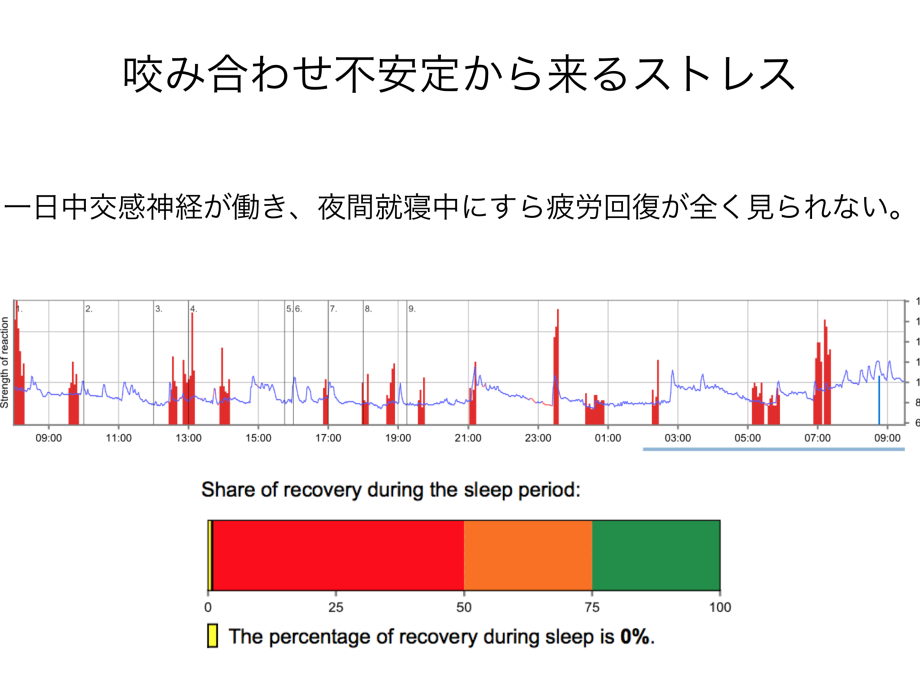 噛み合わせの不安定からくるストレス